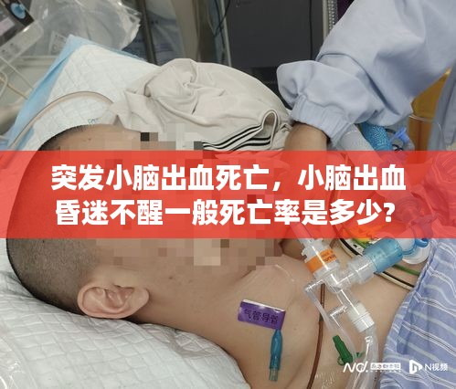 突发小脑出血死亡，小脑出血昏迷不醒一般死亡率是多少? 